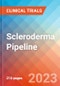 Scleroderma  - 管道Insight，2021  - 产品缩略图图像
