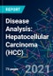疾病分析:肝细胞癌(HCC) -产品缩略图