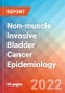 非肌肉浸润性膀胱癌（NMIBC）-到2030年的流行病学预测-产品缩略图