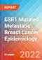 ESR1突变转移性乳腺癌-到2030年的流行病学预测-产品缩略图