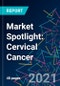 市场焦点：宫颈癌-产品缩略图
